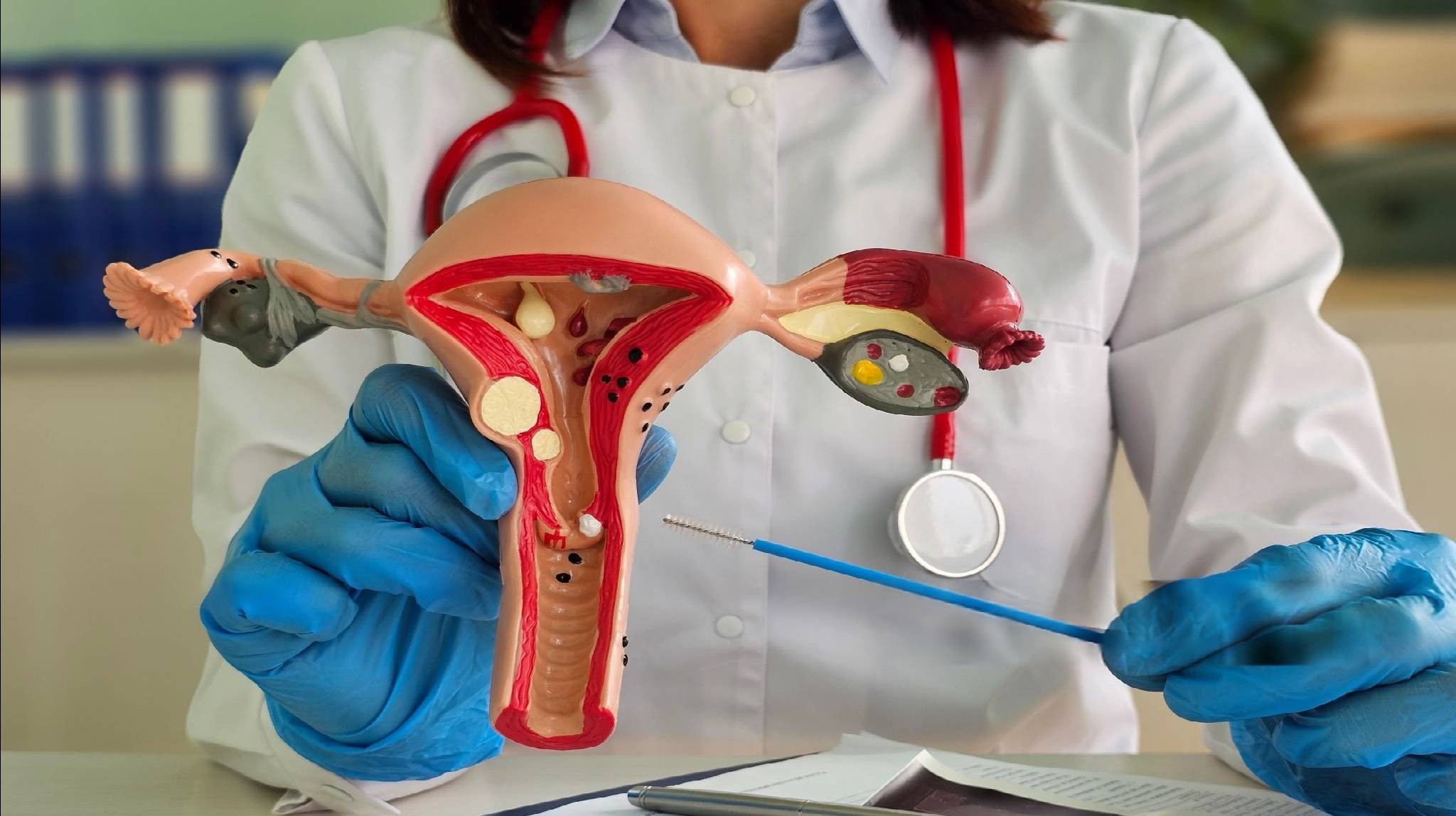 Gynecological Disorders